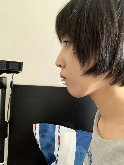 戴牙套第一天的侧面变化_牙套_正畸_摄像头_哈尔滨正畸_美妆_医美整形