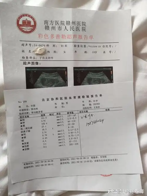 女性在怀孕早期会出现褐色分泌物是什么情况确定妊娠后不准备生育|血