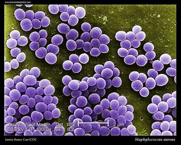【staphylococcus aureus金黄色葡萄球菌.