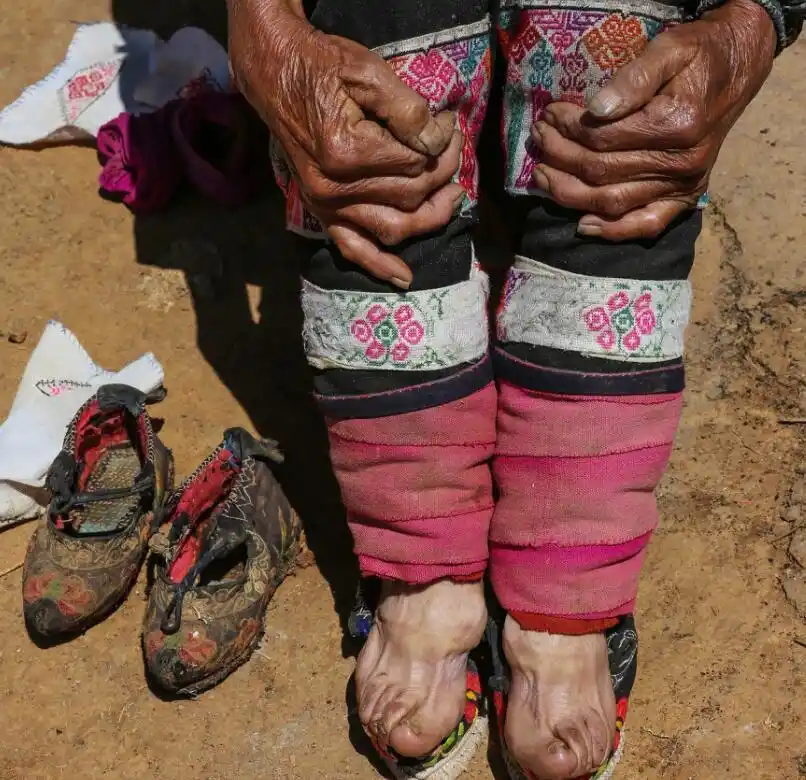 中国最后的裹足老人,用三寸金莲丈量人生,美与痛都将划上句号