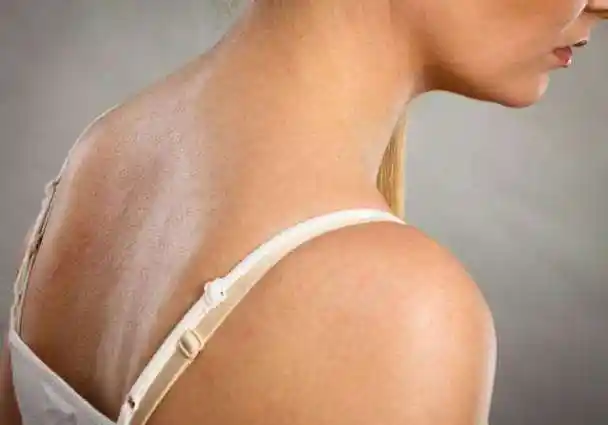 有时候明明刚洗完澡出来,但不久后在后背就能摸到一手的油.