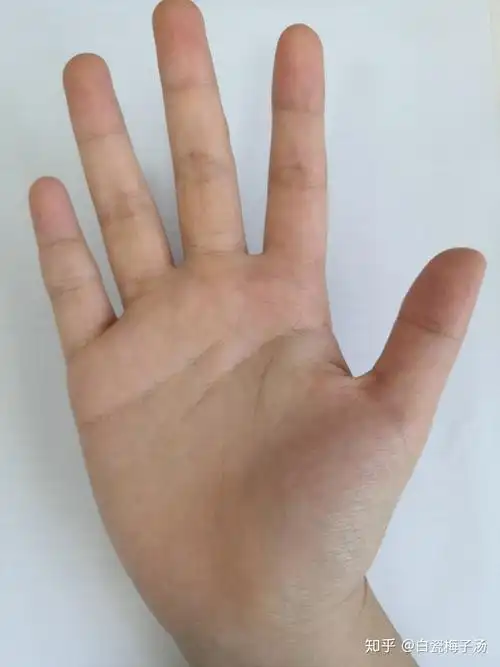 那些得癌症离开人世的年轻朋友,他们手心的生命线是不是很短?