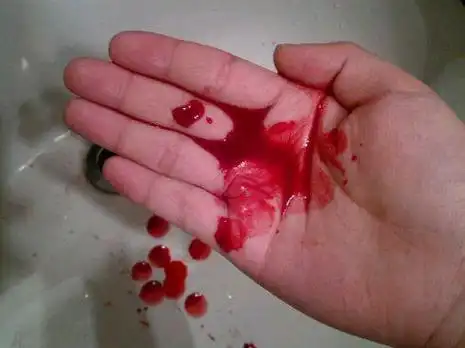 断断续续的好像有20多天 月经期间为什么断断续续流血