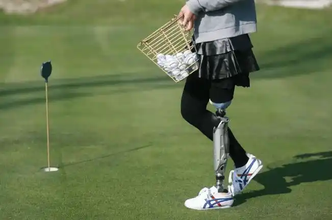 昆明安的好假肢小腿截肢者装配假肢前的保健