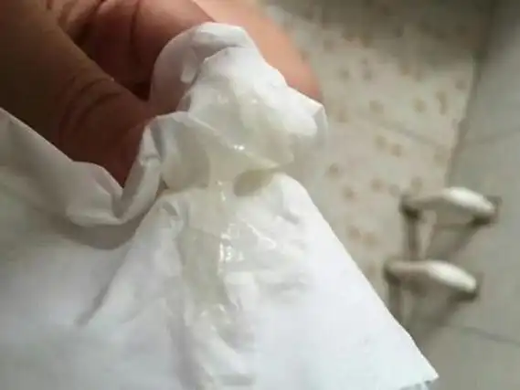 排卵期白带性状图片