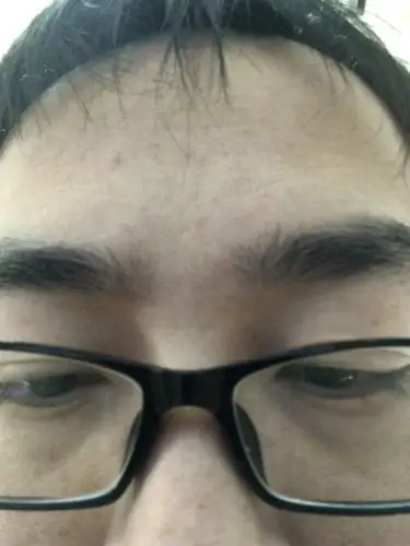 我这个是山根横纹吗?是不是有心脏病风险?