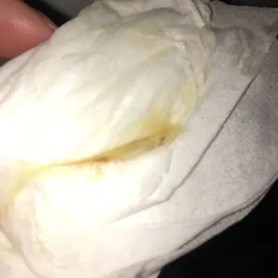 现在怀孕七十几天了,今天内裤出现了这样的白带,肚子没有不适,不知道