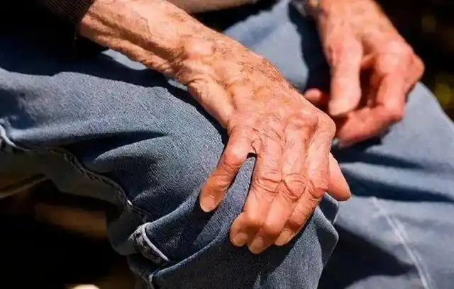 肌无力症状活动后加重,经休息后症状减轻,晨轻暮重是重症肌无力特征性