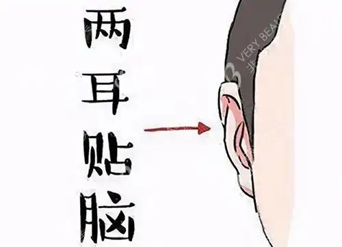 反骨耳能做手术矫正吗耳朵反骨怎么改善方案给分享