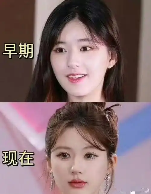 赵露思早期和现在对比 大家觉得哪里变了