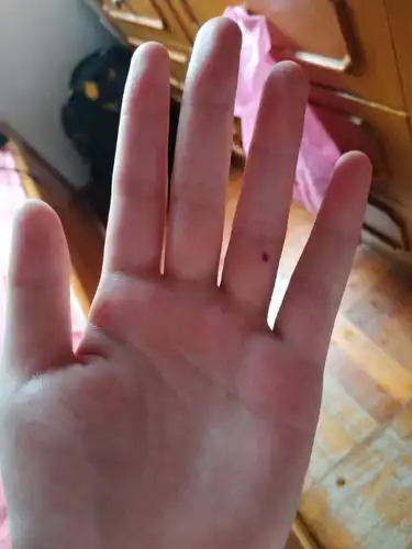 左手有颗痣,这颗痣代表什么意思