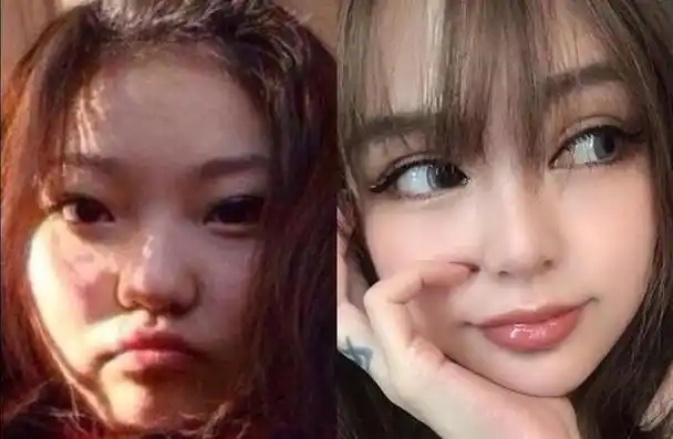 周扬青整容前后对比