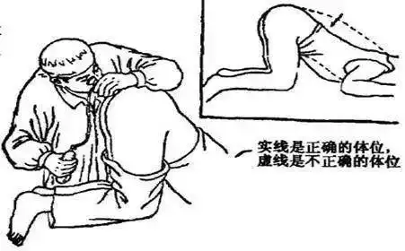 精神痛苦vs快乐源泉肛拭子妙在哪