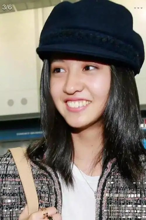 为什么女明星都爱整牙小s早期龅牙自卑佘诗曼以前嘴巴好凸