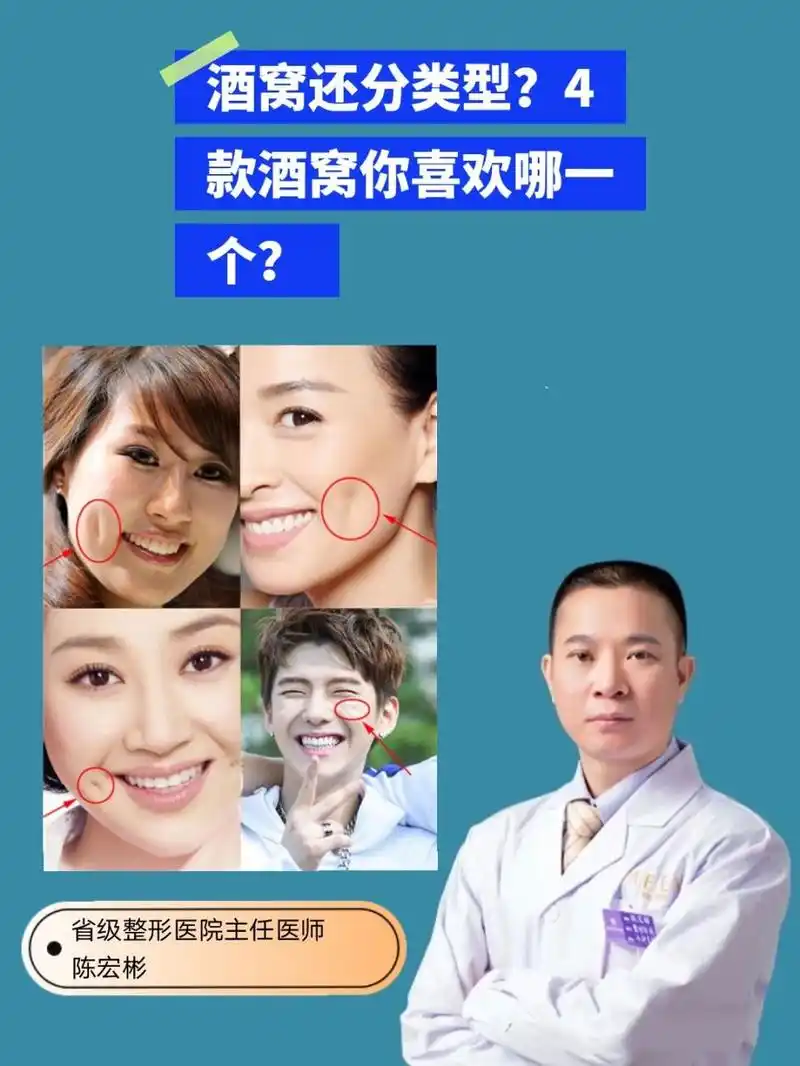4款酒窝你喜欢哪一个?