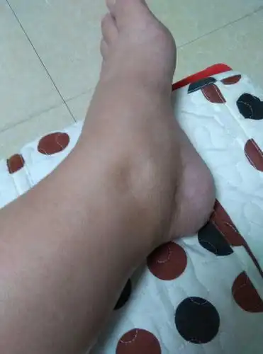 宝贝快点出来吧[泪] 这腿脚