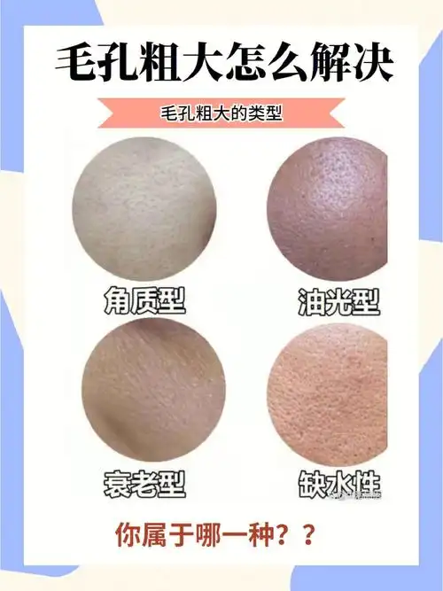 毛孔粗大的原因是什么解决办法来了