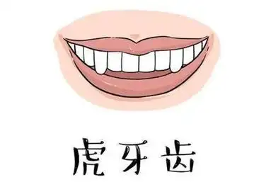 虎牙长的太突出怎么治疗?