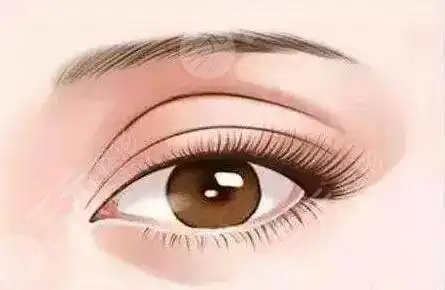 做上睑下垂手术要多少钱费用恢复期注意事项超全分享