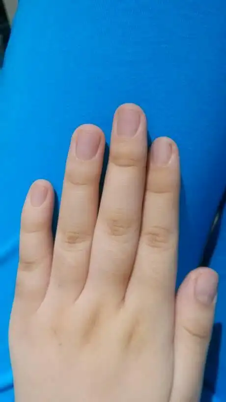 我的指甲颜色正常吗?为什么一冷就感觉手指甲灰白