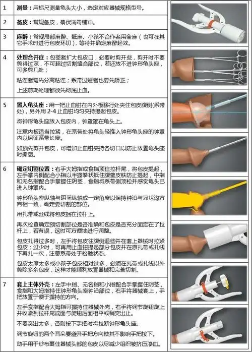 包皮环切缝合器标准操作步骤-狼和