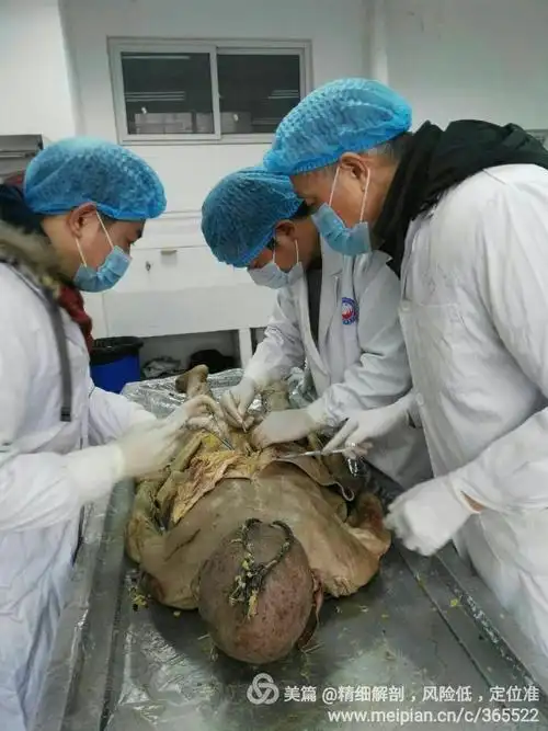 今天,在壅教授和林老师的指导下,在成都医学院搞了一天的尸体解剖.