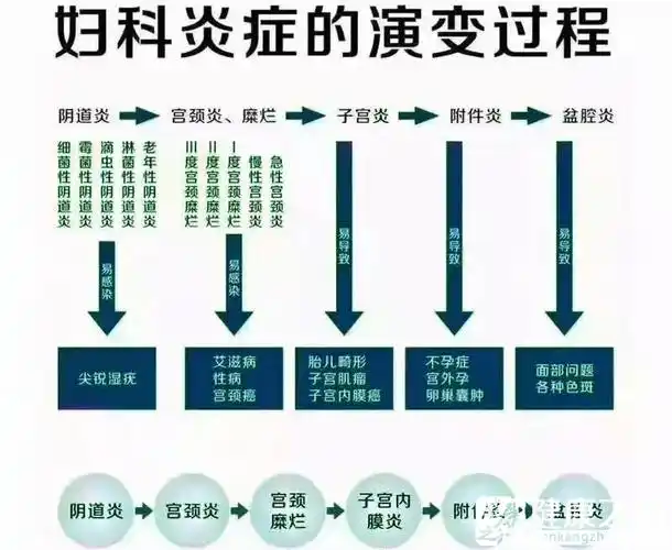 10个女性9个有妇科炎症,你真的重视它了吗?