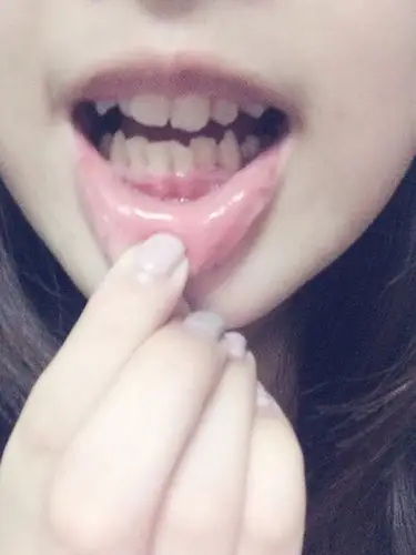 下来的我属虎想我矫正可妈妈却反对了说我不可以把虎牙磨平这是为何呢