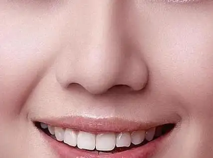 导语:鼻子漂亮你自己更漂亮!这句话是真的.