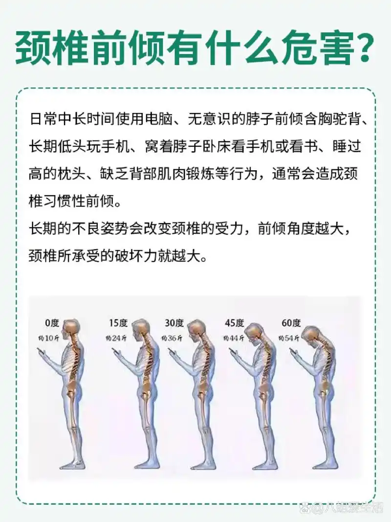 无意识的脖子前倾含胸驼背,长期低头玩手机💥,窝着脖子卧床看手机或