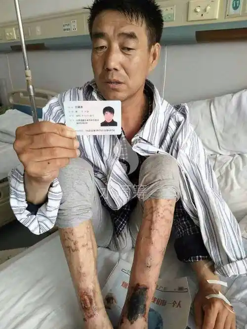 救救我吧!双下肢溃烂,面临截肢…求帮助,求转发