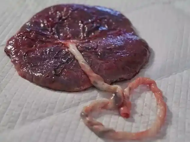 伴着维他命和眼泪一起吃掉了儿子的胎盘