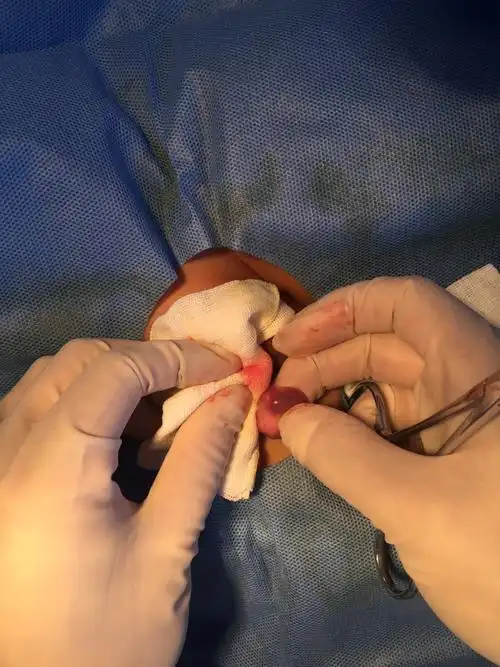 父母大意孩子遭殃 儿童健康应杜绝"疏忽",看看这个痛苦的娃儿