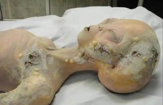 1947年外星人解剖胶片被拍卖作为外星人证据开价100万美元