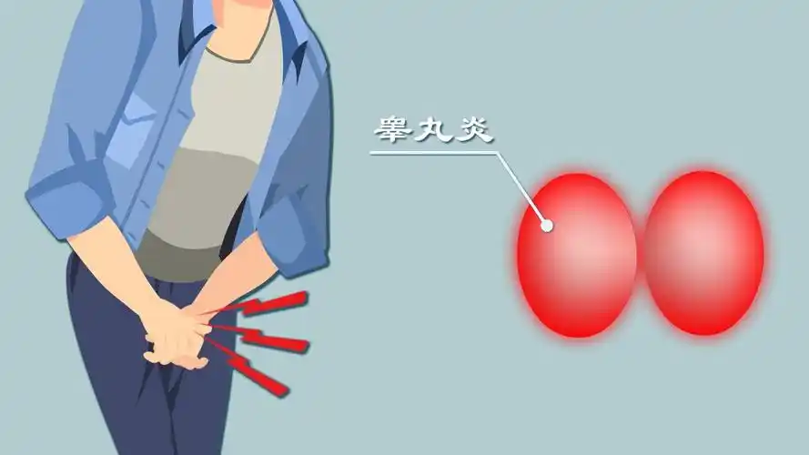 男性睾丸疼痛是什么原因引起的-柳州曙光男科医院