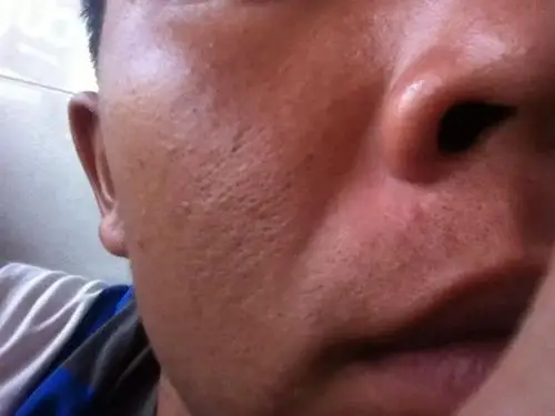 该阳光的年龄光洁紧致的皮肤会让你看起来更精神向上.