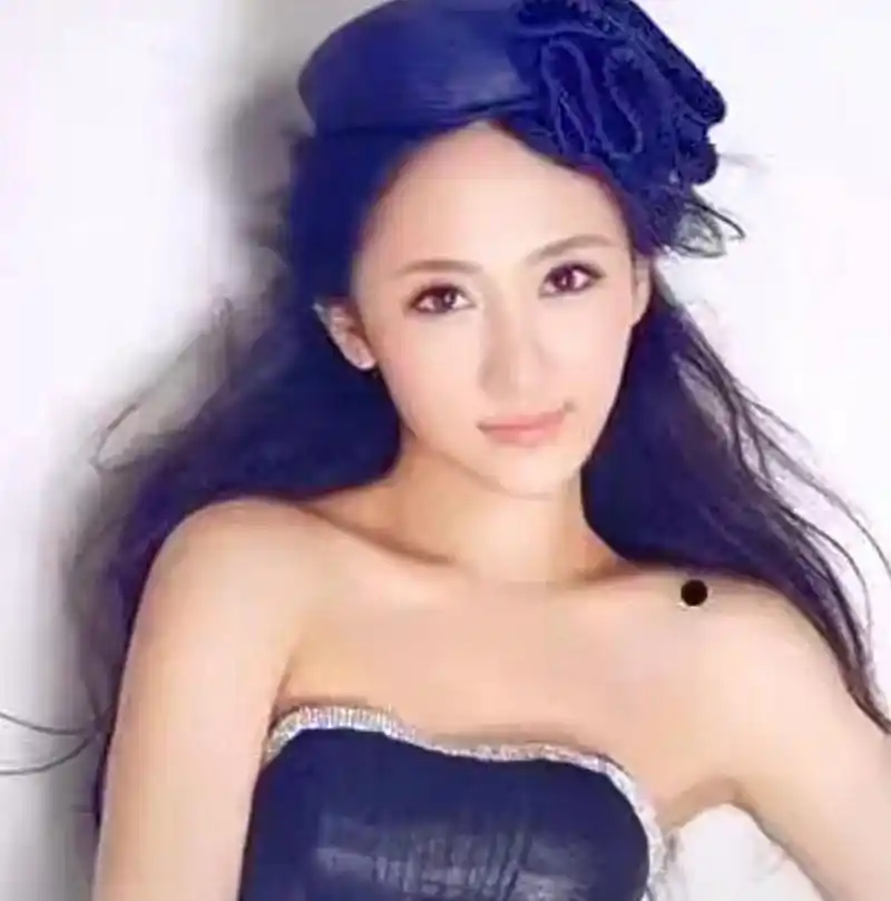 痣的含义(第三篇)-肩膀上的痣 肩膀上长痣代表什么含义?