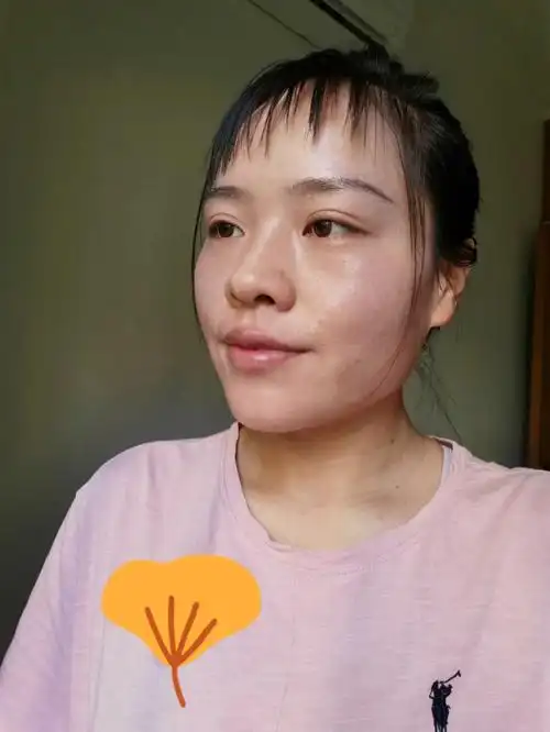 32岁的皮肤状态