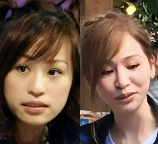 曝王心凌生图变化大,医美脸又僵又肿,商演费52万被指捞金无下限_腾讯