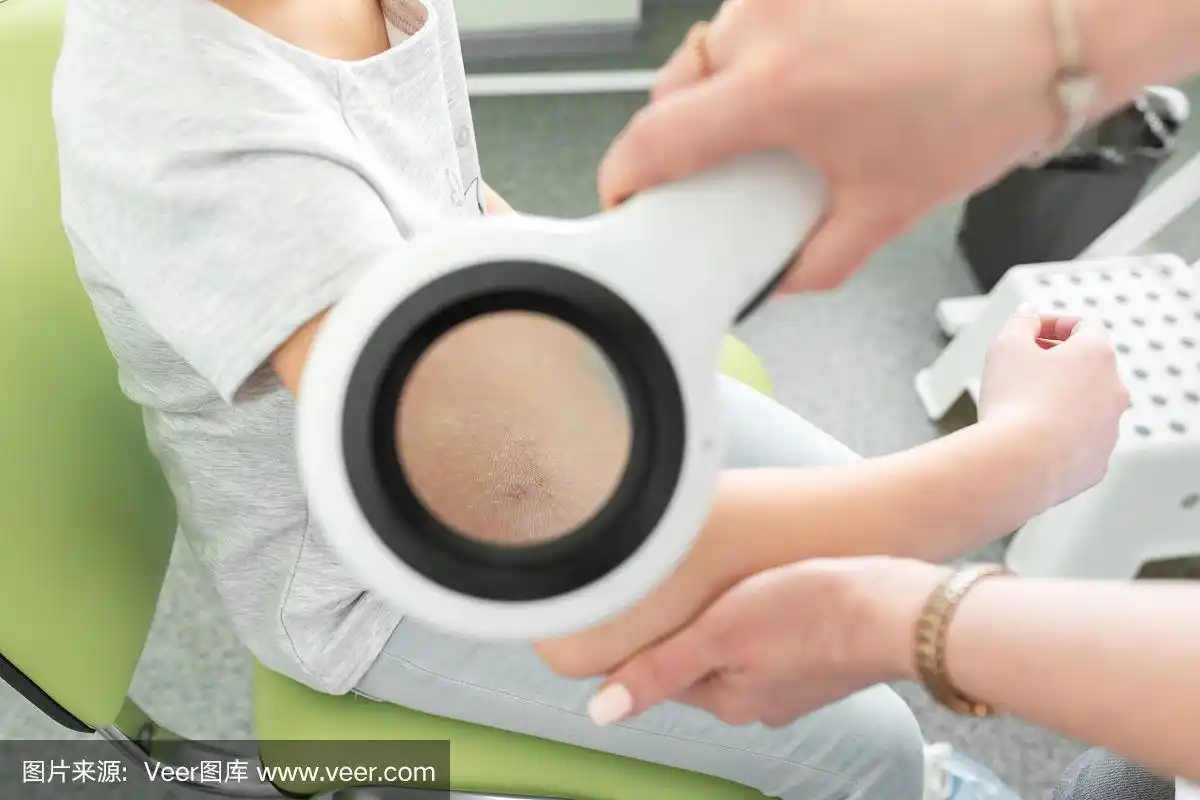 儿科皮肤科医生用皮肤镜检查一个女孩