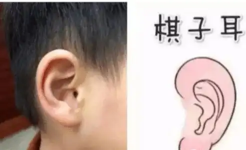 二,棋子耳双耳圆润,没有尖耸或不规整的外形,看上去饱满,有亮泽,就像