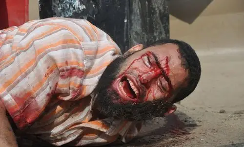 直击埃及最血腥日现场暴力血腥令人不敢直视组图