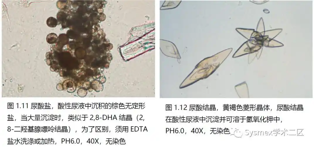 39种尿液结晶形态汇总