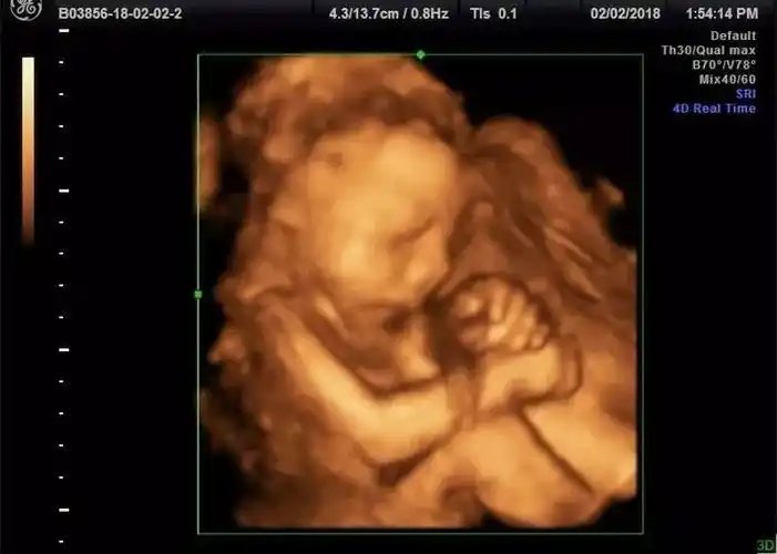 天恩胎儿四维摄影来啦!