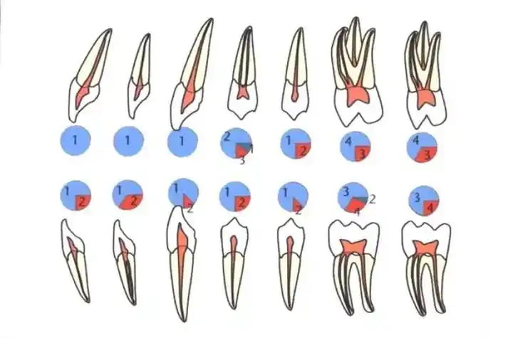 乳牙根管口分布图解