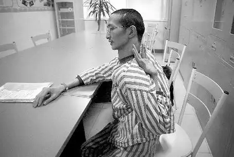 马凡综合征有哪些外貌特征