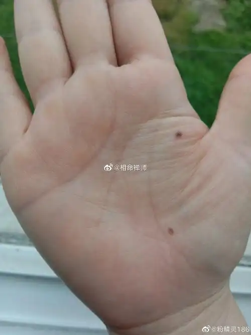 金星丘有痣命中桃花旺盛,掌中有痣大部分来. 来自相命禅师 - 微博