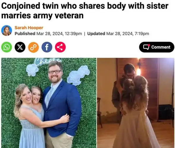 两头共用一身医学奇迹连体双胞胎姐妹嫁人开启3人婚姻