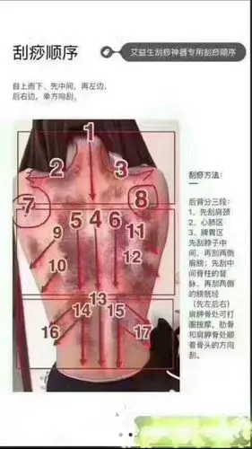 骨质增生,另外刮痧还有调节内脏的作用,这是因为刮痧的具体部位与内脏