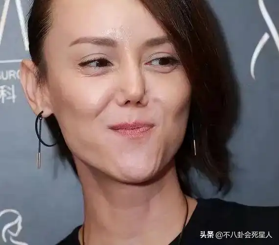 整容失败的二十位明星(娱乐圈整容失败的5大女星)